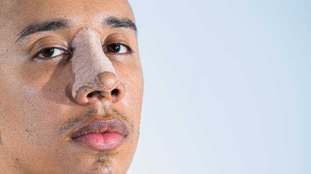 Rhinoplasty in Riyadh avatar